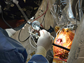 To enable patients with Parkinson’s disease to enjoy a rejuvenated life